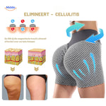 Flexfit-Arten von Cellulite, die verschiedene Texturen und Erscheinungsbilder zeigen.