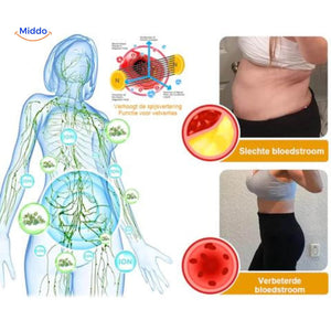 Heat Mapping und Fettreduktionsprozess mit IceSilk™ Shorts