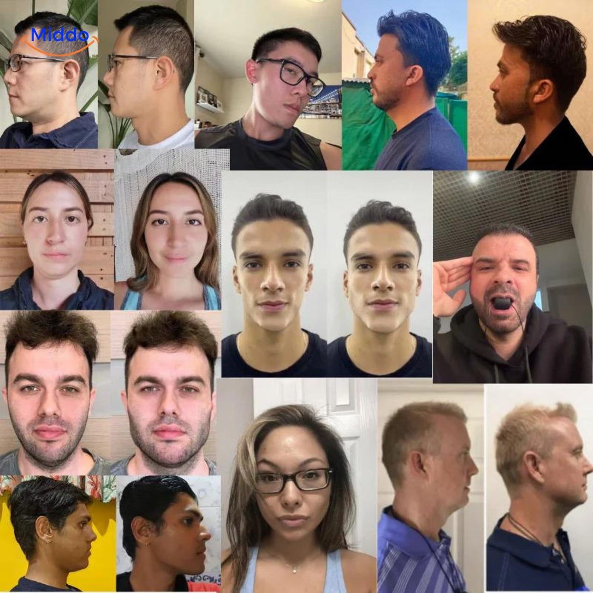 KaakMaster Pro Ergebnisse Collage von Vorher-Nachher-Gesichtsveränderungen