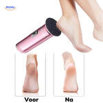 Zapsole™ Vor und Nach der Nutzung